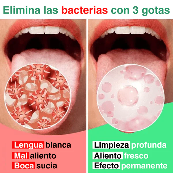 BREATIFY| Gotas naturales para el mal aliento importadas